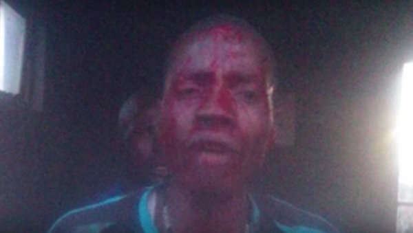 Prostitute stabs man who offered to pay for sex with boiled egg
