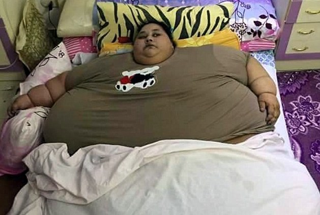 World’s fattest woman to get help from Indian doctor