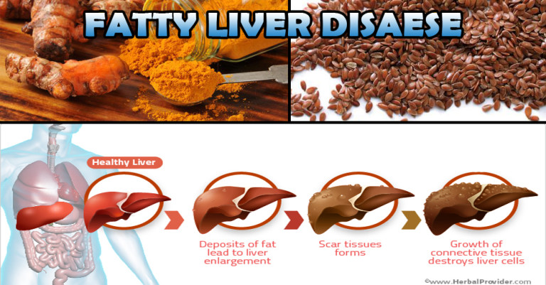 Fatty Liver: What It Is, and How to Get Rid of It