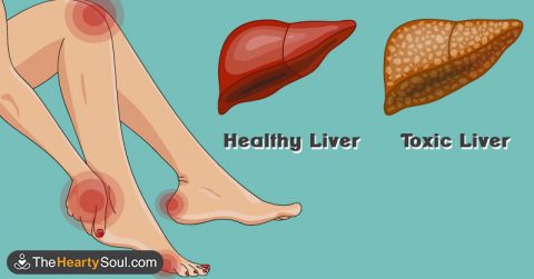 15 Warning Signs Your Liver is Overloaded With Toxins