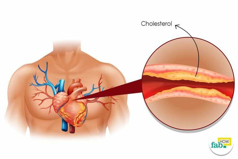 How to reduce cholesterol level without medication