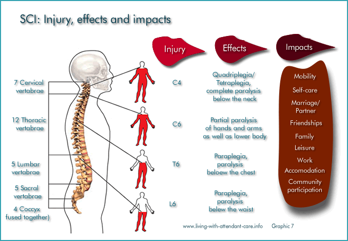 Spinal Cord Injury: Levels, symptoms and treatment