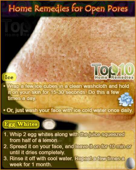 Home remedies for open pores