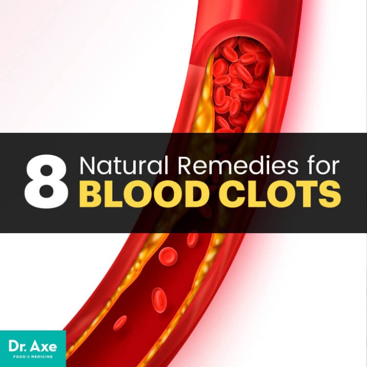 Blood clots: Causes, symptoms and natural remedies