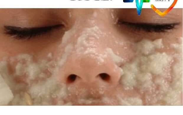 Completely remove dark spots on your face
