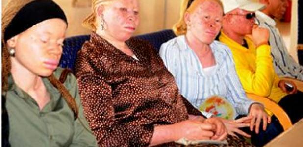 NigerIan govt assures albinos of free skin cancer treatment