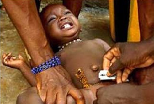 Attempted circumcision kills 11 people in South Africa