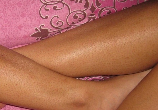 Educative Information About Effective Natural Hair Removal Remedies For The Whole Body by Falmata Zanna