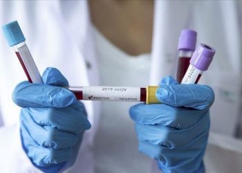 NCDC records 86 new COVID-19 cases