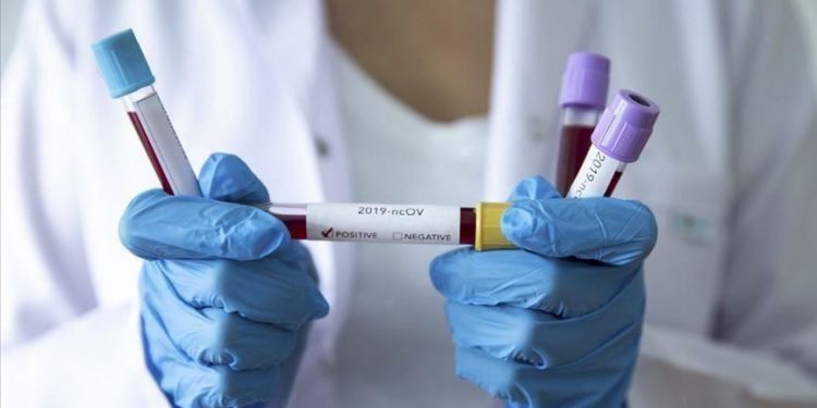 NCDC records 86 new COVID-19 cases