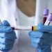 NCDC records 86 new COVID-19 cases