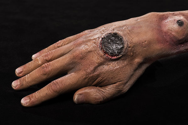 Nigerian government alerts public on outbreak of Anthrax